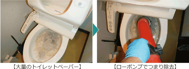 トーラーでトイレットペーパーのつまりを除去
